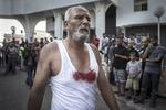 Palestyńczyk w zakrwawionej koszulce wychodzi na ulicę po ataku na szpital. Fot. PAP / EPA
