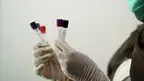 shameersrk-laboratory-5601435_1920.webp