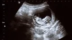 452839326e7a427a9ad12c2ab7543afe.webp